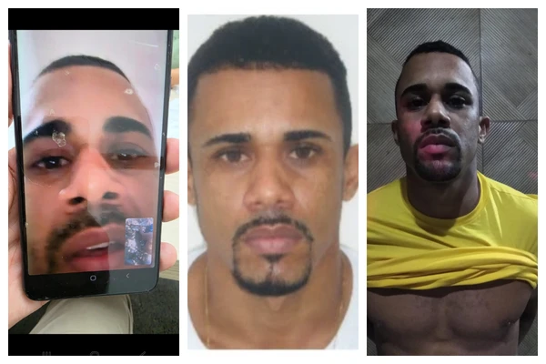 PUNIÇÃO BRUTAL! Estudante de 17 anos tem seis dedos decepados após ser flagrado com gesto de facção rival