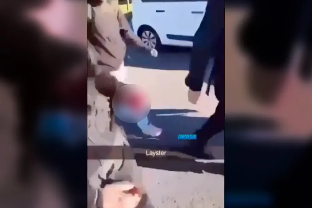 EXPLOSÃO EM PROTESTO! Adolescente de 15 anos perde uma das mãos após pegar granada policial na França