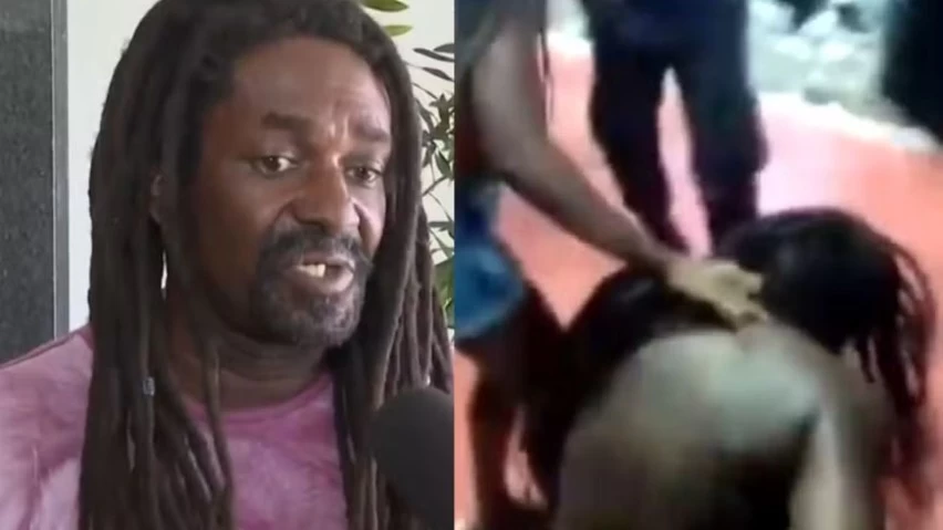 INVESTIGADOR PERDE QUATRO DENTES APÓS AGRESSÃO DE PMs NO CARNAVAL E DEVE RECEBER R$ 100 MIL